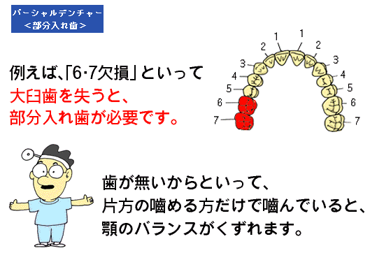 入れ歯について