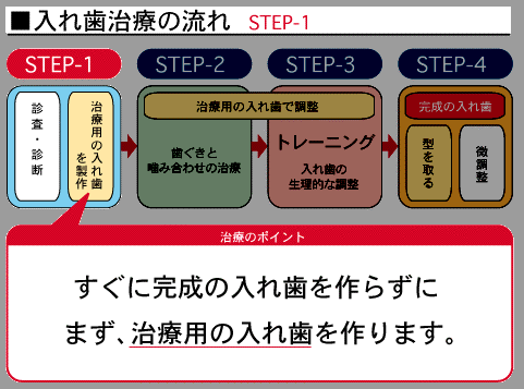 入れ歯について