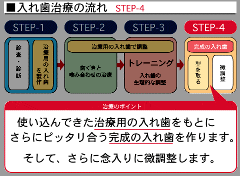 入れ歯について