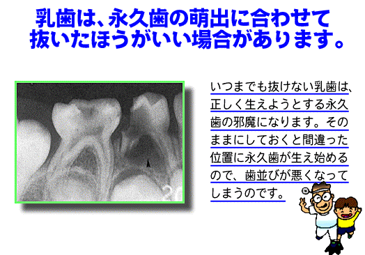 子供の歯を守る