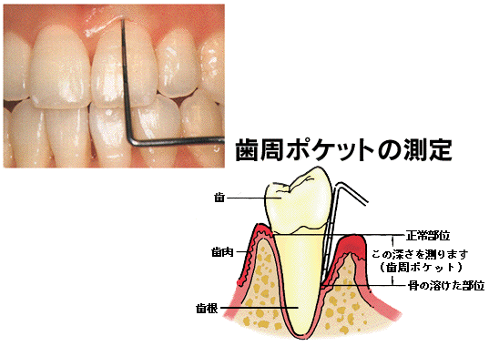 診査